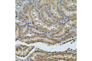 Immunohistochemistry of paraffin-embedded rat kidney using PDCD6IP antibody. (ALIX antibody  (AA 1-180))