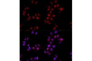 Immunofluorescence analysis of HeLa cells using HMGB1 antibody (ABIN5971378) at dilution of 1/100 (40x lens). (HMGB1 antibody)