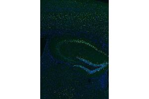 Indirect immunostaining of PFA fixed paraffin embedded mouse hippocampus section (1 : 500; green). (BCL11B antibody)