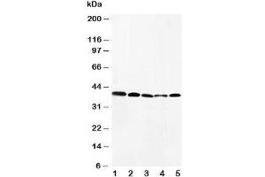Western blot testing of CCR10 antibody and Lane 1:  HeLa;  2: SW620;  3: A549;  4: MM231;  5: SMMC-7721 cell lysate
