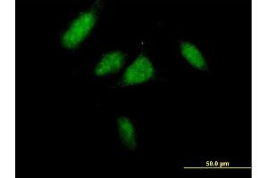 Immunofluorescence of purified MaxPab antibody to CCND3 on HeLa cell. (Cyclin D3 antibody  (AA 1-292))