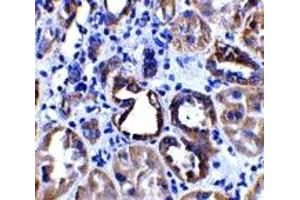 Immunohistochemistry (IHC) image for anti-Angiotensin I Converting Enzyme 2 (ACE2) (Middle Region 2) antibody (ABIN1031195) (ACE2 antibody  (Middle Region 2))