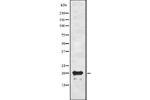 Western blot analysis of ADM using A549 whole cell lysates (Adrenomedullin antibody  (N-Term))