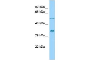 Host: Rabbit Target Name: VGLL4 Sample Type: OVCAR-3 Whole Cell lysates Antibody Dilution: 1. (VGLL4 antibody  (Middle Region))