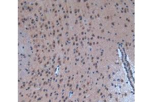IHC-P analysis of brain tissue, with DAB staining. (p300 antibody  (AA 2124-2397))