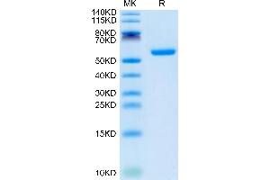 Human CSPG5 on Tris-Bis PAGE under reduced condition. (CSPG5 Protein (AA 31-423) (His tag))