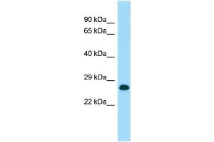 WB Suggested Anti-MOB1A Antibody Titration: 1. (MOB1A antibody  (C-Term))