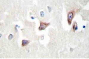 Immunohistochemistry (IHC) analyzes of MRCKbeta antibody in paraffin-embedded human brain tissue. (CDC42BPB antibody)