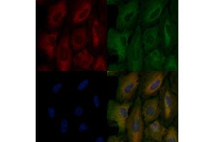 ABIN6257095 and ABIN6275980 staining  cells by IF/ICC. (CNR1 antibody  (N-Term))