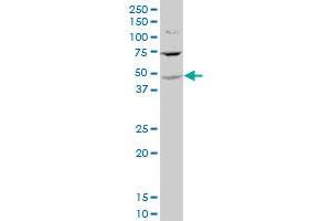 ST6GALNAC2 polyclonal antibody (A01), Lot # 060529JCS1 Western Blot analysis of ST6GALNAC2 expression in HeLa . (ST6GALNAC2 antibody  (AA 161-270))