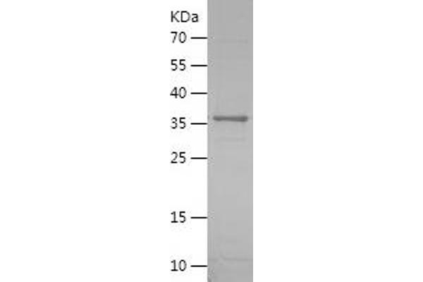 CD57 Protein (AA 35-334) (His tag)