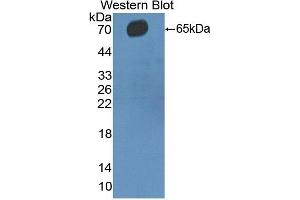 Detection of Recombinant CD5, Human using Polyclonal Antibody to Cluster Of Differentiation 5 (CD5) (CD5 antibody  (AA 25-372))