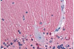 Human Brain, Cerebellum: Formalin-Fixed, Paraffin-Embedded (FFPE) (TUBB2A antibody  (AA 1-446))