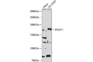 Western blot analysis of extracts of various cell lines, using ITG antibody (ABIN6132866, ABIN6142556, ABIN6142557 and ABIN6214212) at 1:1000 dilution. (ITGA11 antibody  (AA 940-1141))