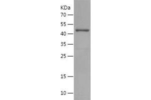 Western Blotting (WB) image for Inhibitor of kappa Light Polypeptide Gene Enhancer in B-Cells, Kinase gamma (IKBKG) (AA 183-339) protein (GST tag) (ABIN7123431) (IKBKG Protein (AA 183-339) (GST tag))
