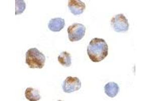 Immunocytochemistry of BMI-1 in K562 cells with AP30158PU-N BMI-1 antibody at 10 μg/ml. (BMI1 antibody  (Intermediate Domain))