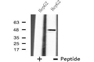 Western blot analysis of extracts from HepG2 cells using B4GALT3 antibody. (B4GALT3 antibody  (Internal Region))