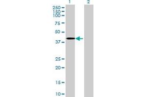 Lane 1: SERPINB10 transfected lysate ( 43. (SERPINB10 293T Cell Transient Overexpression Lysate(Denatured))