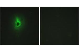 Immunofluorescence analysis of HeLa cells, using Collagen VI alpha3 Antibody. (COL6a3 antibody  (AA 2261-2310))