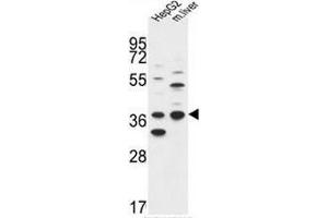 DHRS3 Antibody (Center) western blot analysis in HepG2 cell line and mouse liver tissue lysates (35µg/lane).