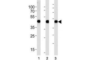 Alpha Actin antibody western blot analysis in (1) A549, (2) RD, and (3) human placenta lysate