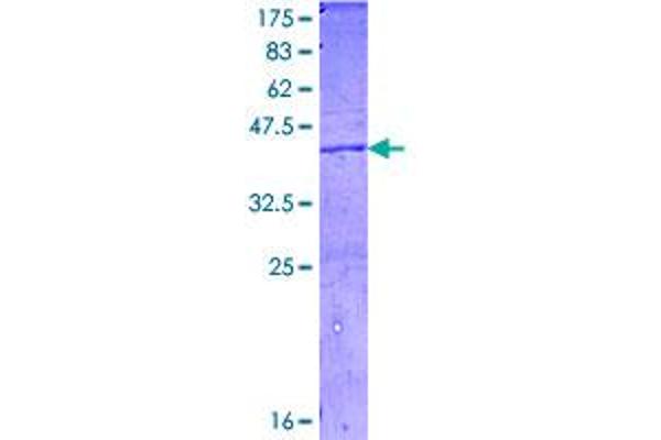 C4A Protein (AA 61-170) (GST tag)