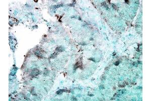 Immunohistochemistry analysis using Mouse Anti-Hsp90 Monoclonal Antibody, Clone 4F3. (HSP90 antibody)