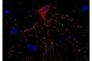 Indirect immunostaining of PFA fixed rat hippocampus neurons with anti-Complexin 1/2 (dilution 1 : 500; red) and mouse anti-synapsin 1 (cat. (Complexin 1, 2 (AA 122-134) antibody)