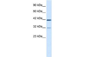 WB Suggested Anti-CHST4 Antibody Titration:  0. (CHST4 antibody  (Middle Region))