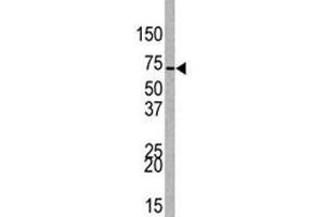 Western Blotting (WB) image for anti-Enhancer of Zeste Homolog 1 (EZH1) (AA 393-422) antibody (ABIN3030806)