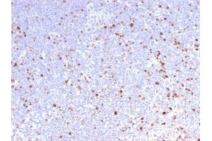 Immunohistochemistry (IHC) image for anti-Minichromosome Maintenance Complex Component 7 (MCM7) (AA 195-319) antibody (ABIN6940025)