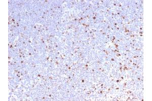 Formalin-fixed, paraffin-embedded human Lymph Node stained with MCM7 Rabbit Recombinant Monoclonal Antibody (MCM7/2832R). (Recombinant MCM7 antibody  (AA 195-319))