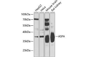 Western blot analysis of extracts of various cell lines, using ASPA Antibody (ABIN6127373, ABIN6137211, ABIN6137212 and ABIN6223094) at 1:500 dilution. (ASPA antibody  (AA 1-313))