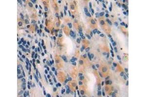 Used in DAB staining on fromalin fixed paraffin-embedded stomach tissue (MYLK3 antibody  (AA 555-786))
