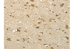 The image on the left is immunohistochemistry of paraffin-embedded Human brain tissue using ABIN7131002(SEMA4F Antibody) at dilution 1/35, on the right is treated with fusion protein. (SEMA4F antibody)