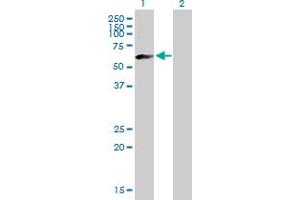 Western Blot analysis of IGHM expression in transfected 293T cell line by IGHM MaxPab polyclonal antibody. (IGHM antibody  (AA 1-489))