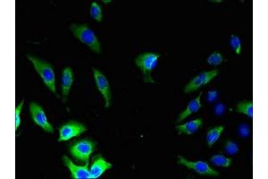 Immunofluorescent analysis of A549 cells using ABIN7153621 at dilution of 1:100 and Alexa Fluor 488-congugated AffiniPure Goat Anti-Rabbit IgG(H+L) (GJB5 antibody  (AA 211-273))