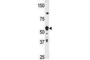 Image no. 1 for anti-Zinc Finger Protein 395 (ZNF395) (Center) antibody (ABIN357344) (ZNF395 antibody  (Center))