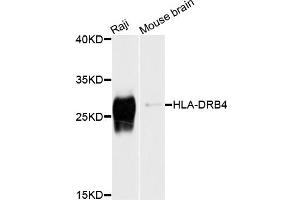 Western blot analysis of extracts of various cell lines, using HLA-DRB4 antibody (ABIN6003784) at 1/1000 dilution. (HLA-DRB4 antibody)