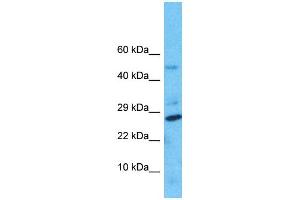 Western Blotting (WB) image for anti-Nudix Hydrolase 8 (NUDT8) (N-Term) antibody (ABIN2791709) (NUDT8 antibody  (N-Term))