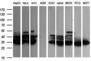 Image no. 1 for anti-Fetal and Adult Testis Expressed 1 (FATE1) antibody (ABIN1498225) (FATE1 antibody)