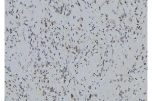 ABIN6279400 at 1/100 staining Human gastric tissue by IHC-P. (RNF123 antibody  (N-Term))