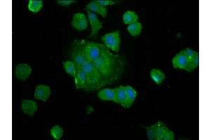 Immunofluorescence staining of MCF-7 cells with ABIN7149870 at 1:133, counter-stained with DAPI. (SAT2 antibody  (AA 1-170))