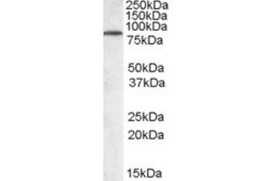 Western Blotting (WB) image for anti-Tripartite Motif Containing 3 (TRIM3) (N-Term) antibody (ABIN2465468)