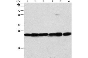 Western Blot analysis of Mouse liver and brain tissue, 293T, A549, A431 and PC3 cell using SIGMAR1 Polyclonal Antibody at dilution of 1:310 (SIGMAR1 antibody)