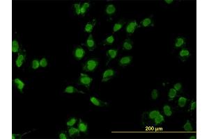 Immunofluorescence of monoclonal antibody to MEOX2 on HeLa cell. (MEOX2 antibody  (AA 1-303))