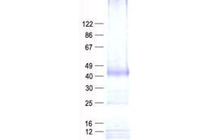 Validation with Western Blot