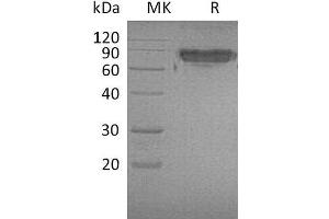 Western Blotting (WB) image for Intercellular Adhesion Molecule 2 (ICAM2) protein (Fc Tag) (ABIN7320710) (ICAM2 Protein (Fc Tag))
