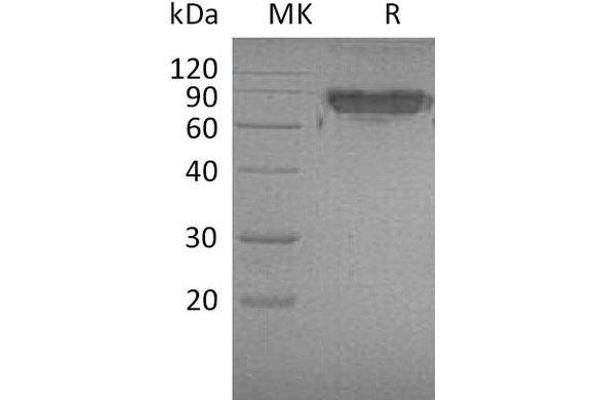 ICAM2 Protein (Fc Tag)