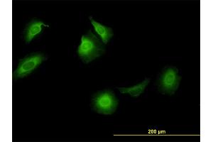 Immunofluorescence of monoclonal antibody to CCT5 on HeLa cell. (CCT5 antibody  (AA 1-541))
